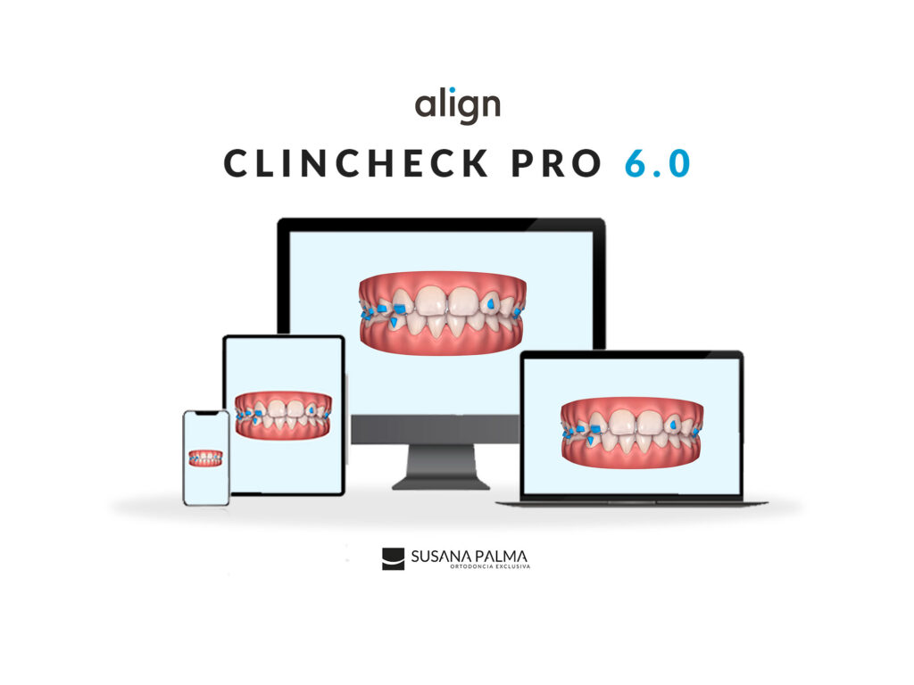 ClinCheck Pro 6.0