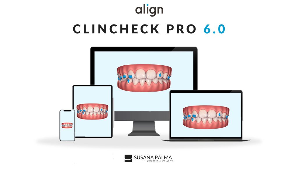 ClinCheck Pro 6.0